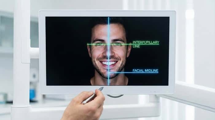 Facially Driven Design و خطوط مرجع صورت در طراحی لبخند