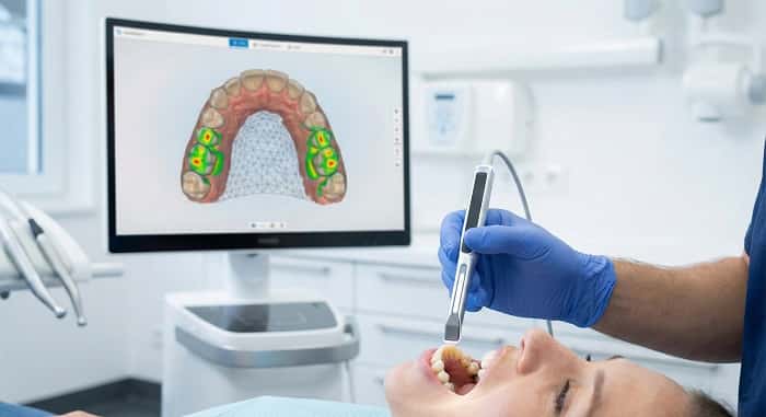 اسکن داخل دهانی سه‌بعدی با اسکنر داخل دهانی