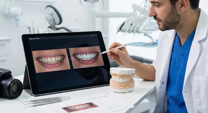 طراحی CAD/CAM در طراحی دیجیتال دندانپزشکی برای روکش و ونیر