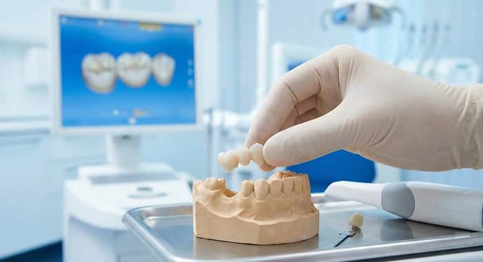 «قبل و بعد درمان بریج دندانی برای جایگزینی دندان از دست رفته»