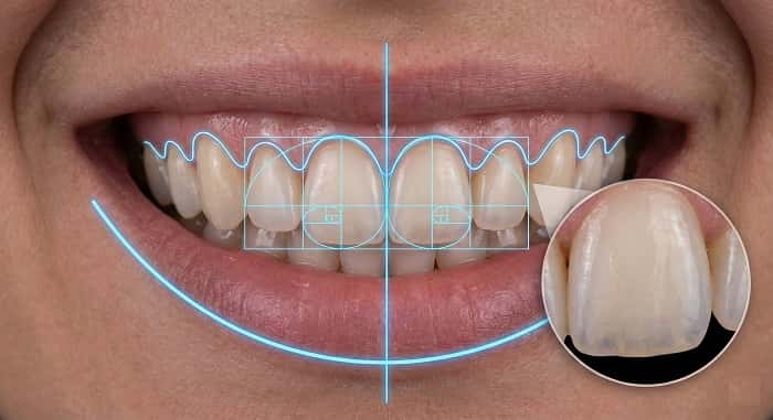 درمان‌های زیبایی لبخند