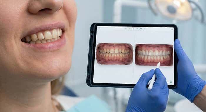 درمان‌های زیبایی لبخند