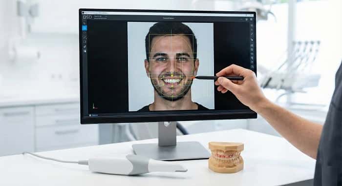 طراحی لبخند دیجیتال (Smile Design)