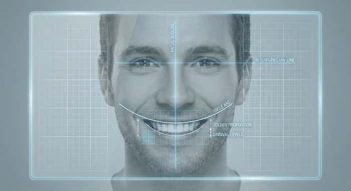 سوالات متداول طراحی لبخند دیجیتال و تحلیل خطوط مرجع