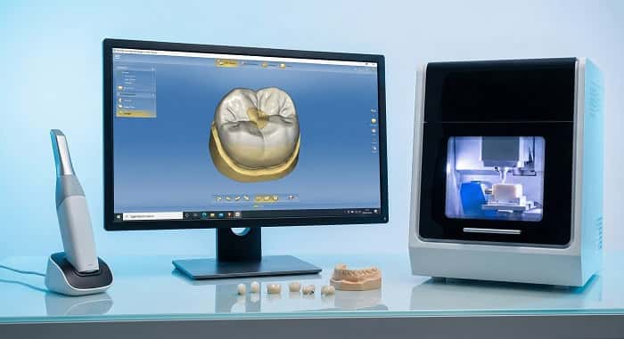 اسکن دیجیتال دندان‌ها با اسکنر داخل دهانی در سیستم CAD/CAM دندانپزشکی