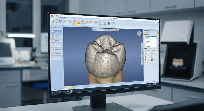 طراحی دیجیتال روکش دندان با نرم‌افزار CAD در لابراتوار دندانپزشکی