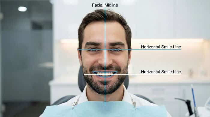 اصول زیبایی در طراحی لبخند و هم‌راستایی خط میانی