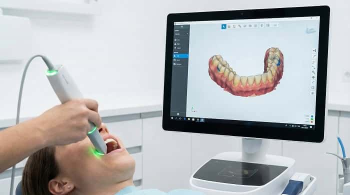 اسکن داخل دهانی در طراحی دیجیتال دندانپزشکی