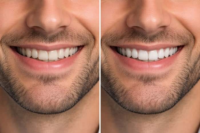 فناوریهای نوین دندان پزشکی