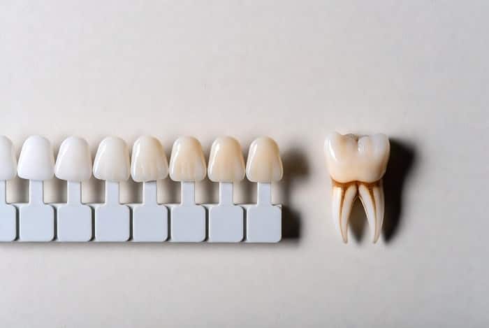 مدیریت رنگ دیجیتال در دندانسازی