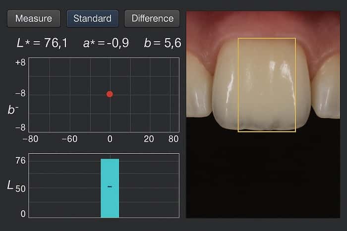 عکاسی استاندارد برای انتخاب شید دندان در سیستم دیجیتال
