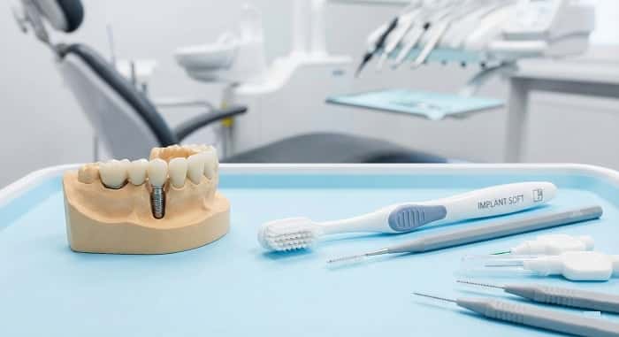 مسواک مخصوص ایمپلنت؛ چه مسواکی برای ایمپلنت دندان مناسب است؟