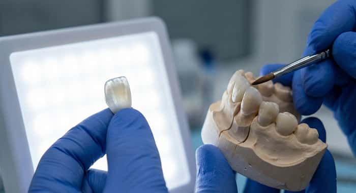 ونیر کامپوزیت و اهمیت پولیش در ثبات رنگ و درخشندگی