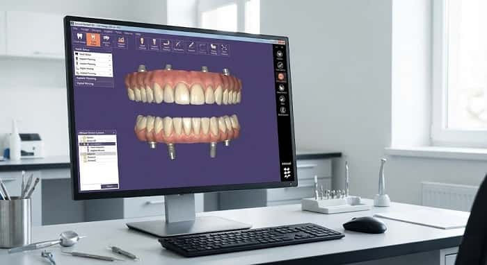 طراحی دیجیتال پروتز کامل ثابت روی ایمپلنت در لابراتوار تخصصی دیجیتال