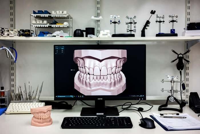 استفاده از چک لیست تکمیلشده در لابراتوار تخصصی دیجیتال اسپیدنت برای مدیریت کیس دیجیتال