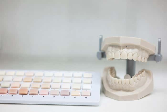 چک‌لیست ارسال کیس به لابراتوار دیجیتال دندانسازی