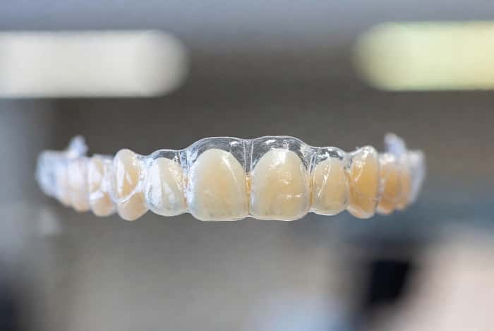 کاربرد لابراتوار دیجیتال در ارتودنسی اینویزیبل و الاینر شفاف