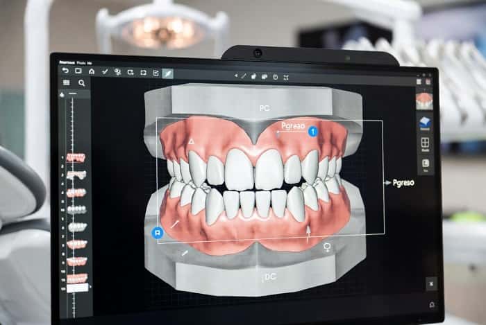 طراحی دیجیتال حرکت دندانی برای ارتودنسی اینویزیبل در نرمافزار لابراتوار