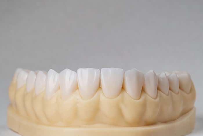 تفاوت سیستم‌های CAD/CAM کلینیکی و لابراتواری در دندانپزشکی دیجیتال