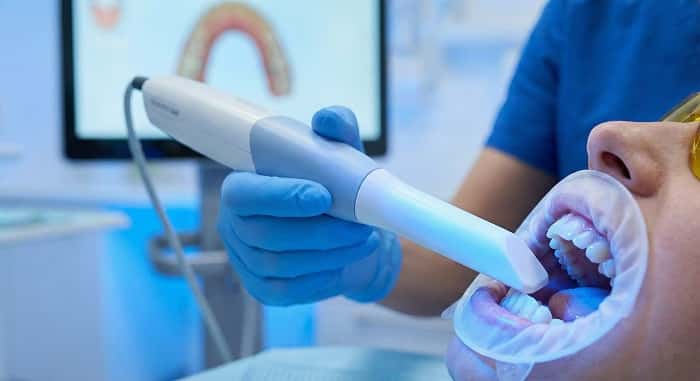 اسکنر داخل دهانی