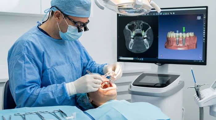 استن‌های سه‌بعدی و گایدهای جراحی ایمپلنت