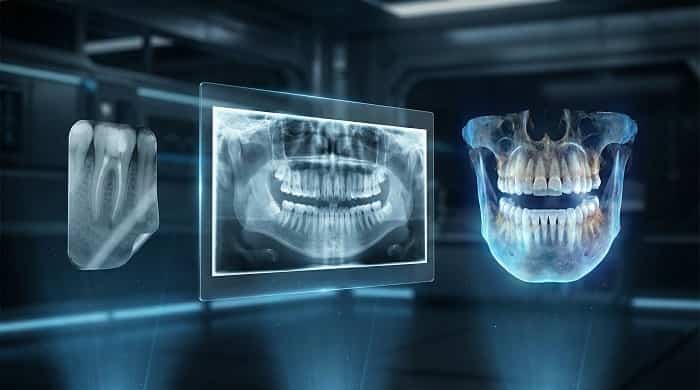انواع روش‌های تصویربرداری برای ایمپلنت؛ از عکس ساده تا تصویربرداری سه‌بعدی
