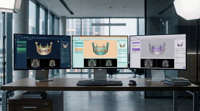 بهترین نرم‌افزارهای طراحی ایمپلنت دیجیتال 