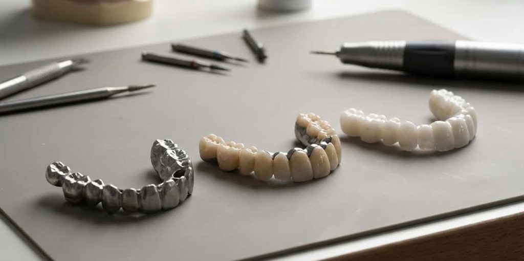 ایمپلنت فول آرچ