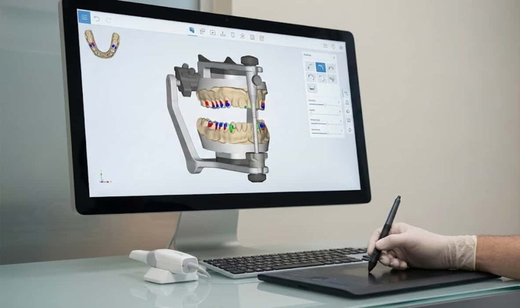 نرم‌افزارهای آنالیز اکلوژن