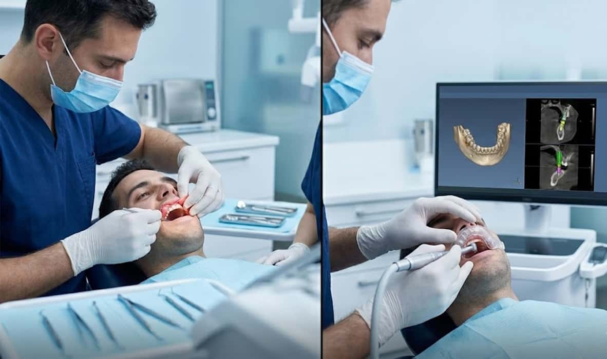 مقایسه ایمپلنت بدون جراحی و جراحی باز؛ کدام روش در کدام شرایط منطقی‌تر است؟